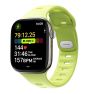 Nomad Tempo Band Correa para Apple Watch 38mm/ 40mm/ 41mm/ 42mm Lime sticky